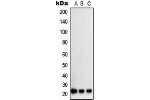 Western blot analysis of SOCS2 expression in K562 (A), A204 (B), PC12 (C) whole cell lysates.