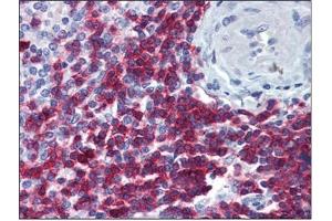 Immunohistochemistry (IHC) image for anti-CD247 Molecule (CD247) (AA 1-165) antibody (ABIN782349)
