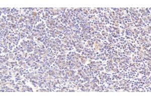 Detection of C3a in Human Spleen Tissue using Polyclonal Antibody to Complement Component 3a (C3a) (C3a anticorps  (AA 672-748))