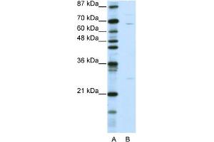 WB Suggested Anti-KLHL13 Antibody Titration:  0. (KLHL13 anticorps  (N-Term))