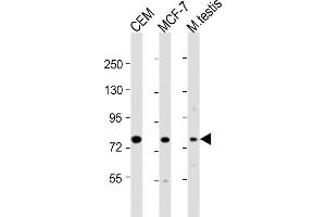 All lanes : Anti-MYBL2 Antibody (C-Term) at 1:8000 dilution Lane 1: CEM whole cell lysate Lane 2: MCF-7 whole cell lysate Lane 3: mouse testis lysate Lysates/proteins at 20 μg per lane. (MYBL2 anticorps  (AA 540-571))