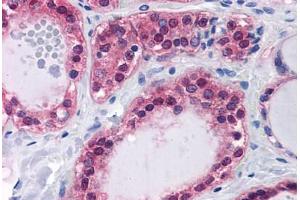 Human Thyroid: Formalin-Fixed, Paraffin-Embedded (FFPE)