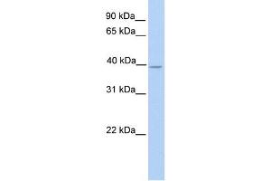 NEK6 antibody used at 1 ug/ml to detect target protein. (NEK6 anticorps)
