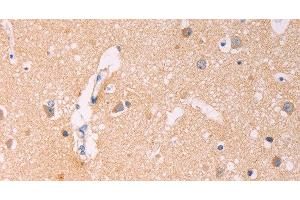 Immunohistochemistry of paraffin-embedded Human brain using ADCY1 Polyclonal Antibody at dilution of 1:60 (ADCY1 anticorps)