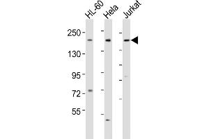 All lanes : Anti-DIP2A Antibody (Center) at 1:1000-1:2000 dilution Lane 1: HL-60 whole cell lysates Lane 2: Hela whole cell lysates Lane 3: Jurkat whole cell lysates Lysates/proteins at 20 μg per lane. (DIP2A anticorps  (AA 934-969))