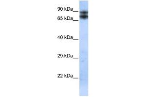WB Suggested Anti-LIMA1 Antibody Titration:  0. (LIMA1 anticorps  (N-Term))