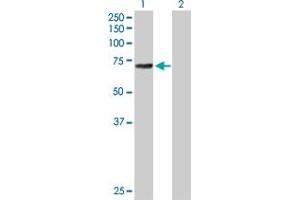 Western Blot analysis of ALOX12 expression in transfected 293T cell line by ALOX12 MaxPab polyclonal antibody. (ALOX12 anticorps  (AA 1-663))