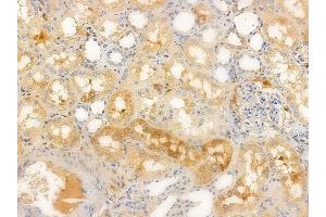 ABIN6256394 and ABIN6267617 at 1/100 staining human normal kidney tissue by IHC-P. (PKC delta anticorps  (pSer645))