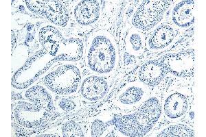 ABIN1590026 Negative Control showing staining of paraffin embedded Human Testis, with no primary antibody. (HOXA10 anticorps  (Internal Region))
