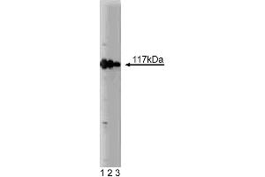 Western blot analysis of rabaptin-5 on a MCF-7 lysate. (RABEP1 anticorps  (AA 247-417))