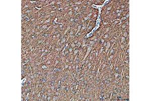 IHC analysis of Synapsin II using anti-Synapsin II antibody (ABIN4886735).