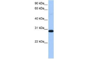 WARS2 antibody used at 1 ug/ml to detect target protein. (WARS2 anticorps  (Middle Region))