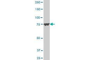 PCSK6 polyclonal antibody (A01), Lot # FIS28060515QCS1 Western Blot analysis of PCSK6 expression in Hela S3 NE .