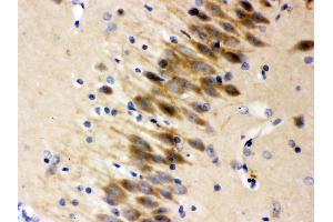 Anti- Otoferlin Picoband antibody,IHC(P) IHC(P): Rat Brain Tissue