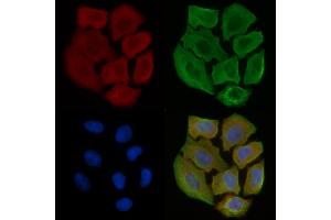 ABIN6256944 and ABIN6275250 staining Hela cells(30 min of UV treatment) by IF/ICC.