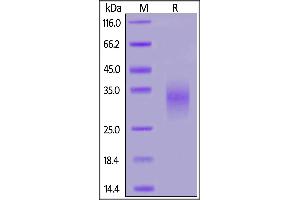 Human NKG2D, His Tag on  under reducing (R) condition. (KLRK1 Protein (AA 73-216) (His tag))
