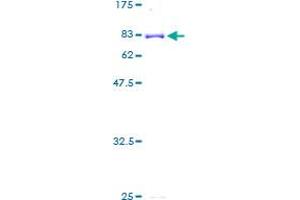 Image no. 1 for Cytochrome P450, Family 3, Subfamily A, Polypeptide 5 (CYP3A5) (AA 1-502) protein (GST tag) (ABIN1350994)