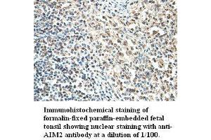 Image no. 1 for anti-Absent in Melanoma 2 (AIM2) antibody (ABIN791198) (AIM2 anticorps)
