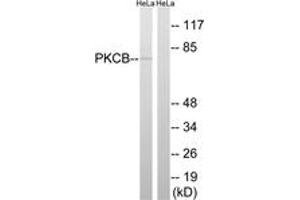 Western blot analysis of extracts from HeLa cells, using PKCB (Ab-661) Antibody. (PKC beta anticorps  (AA 622-671))