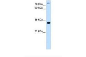 anti-TAM41, Mitochondrial Translocator Assembly and Maintenance Protein (TAMM41) (N-Term) antibody