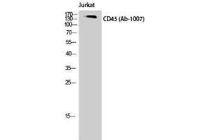 Western Blotting (WB) image for anti-Protein tyrosine Phosphatase, Receptor Type, C (PTPRC) (Thr505) antibody (ABIN6285411)