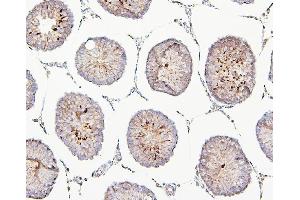 IHC analysis of TEK using anti-TEK antibody (ABIN7600762). (TEK anticorps  (AA 23-616))