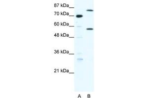 Western Blotting (WB) image for anti-Myoneurin (MYNN) antibody (ABIN2460664) (Myoneurin anticorps)