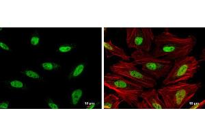 ICC/IF Image OCT1 antibody detects OCT1 protein at nucleus by immunofluorescent analysis. (POU2F1 anticorps)