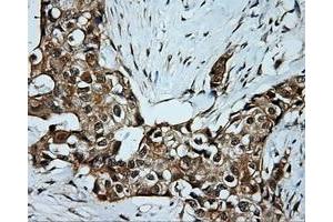 Immunohistochemical staining of paraffin-embedded Kidney tissue using anti-SRR mouse monoclonal antibody. (SRR anticorps)