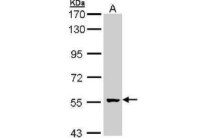GCM2 anticorps  (Center)