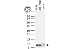 Western blot analysis of PYDC1 using PYDC1 polyclonal antibody  at 1 : 2000. (PYDC1 anticorps)