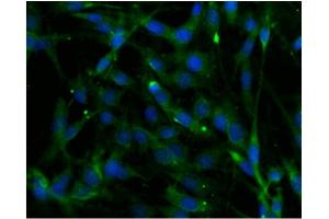Immunofluorescence (IF) image for anti-Phospholipase C beta 4 (PLCb4) (AA 752-961) antibody (ABIN968583)