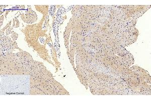 Immunohistochemical analysis of paraffin-embedded mouse heart tissue. (PIK3R1 anticorps  (pTyr607))