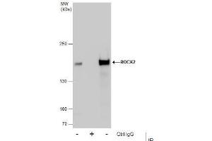 IP Image Immunoprecipitation of ROCK2 protein from HeLa whole cell extracts using 5 μg of ROCK2 antibody, Western blot analysis was performed using ROCK2 antibody, EasyBlot anti-Rabbit IgG  was used as a secondary reagent. (ROCK2 anticorps)