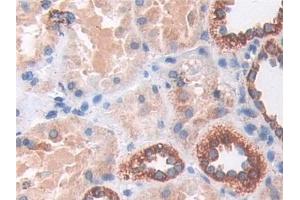 Detection of SOD2 in Human Kidney Tissue using Polyclonal Antibody to Superoxide Dismutase 2, Mitochondrial (SOD2) (SOD2 anticorps  (AA 25-222))