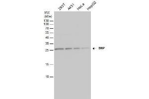 WB Image BNP antibody detects BNP protein by western blot analysis. (NPPB anticorps)