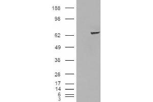 Image no. 2 for anti-Insulin-Like Growth Factor 2 mRNA Binding Protein 2 (IGF2BP2) (C-Term) antibody (ABIN374940) (IGF2BP2 anticorps  (C-Term))