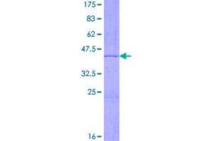 Image no. 1 for Histone Cluster 2, H3a (HIST2H3A) (AA 1-136) protein (GST tag) (ABIN7565576)