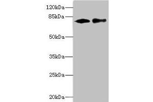 Western blot All lanes: CALCOCO1 antibody at 1. (CALCOCO1 anticorps  (AA 462-691))