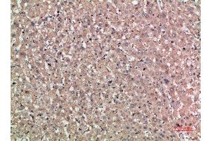 Immunohistochemical analysis of paraffin-embedded human-liver, antibody was diluted at 1:200 (NOG anticorps  (AA 21-70))