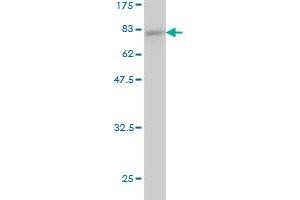 Western Blot detection against Immunogen (71. (ACTR3 anticorps  (AA 1-418))