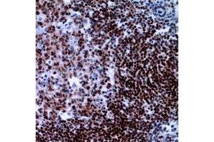 Immunohistochemical analysis of XRCC3 staining in human tonsil formalin fixed paraffin embedded tissue section.