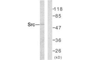 Western blot analysis of extracts from COLO205 cells, using Src (Ab-418) Antibody. (Src anticorps  (AA 386-435))
