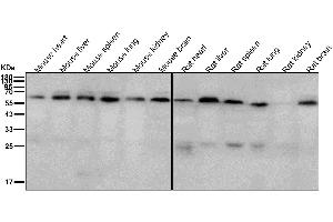All lanes use the Antibody at 1:2K dilution for 1 hour at room temperature.