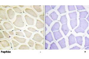Immunohistochemistry analysis of paraffin-embedded human skeletal muscle tissue using COL20A1 polyclonal antibody . (COL20A1 anticorps  (C-Term))