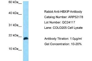 Western Blotting (WB) image for anti-Hepatitis B Virus X-Interacting Protein (HBXIP) (N-Term) antibody (ABIN2784810)