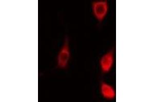 ABIN6278263 staining  NIH-3T3 cells by IF/ICC. (MAPKAP Kinase 2 anticorps  (C-Term))