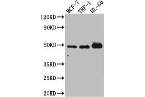 Western Blot Positive WB detected in: MCF-7 whole cell lysate, THP-1 whole cell lysate, HL-60 whole cell lysate All lanes: Vitamin D antibody at 1:1000 Secondary Goat polyclonal to rabbit IgG at 1/50000 dilution Predicted band size: 49, 54 kDa Observed band size: 49 kDa (Recombinant Vitamin D Receptor anticorps)