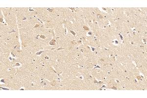 Detection of DMD in Human Cerebrum Tissue using Monoclonal Antibody to Dystrophin (DMD) (Dystrophin anticorps  (AA 253-597))