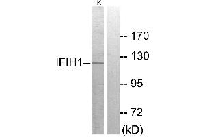 Western blot analysis of extracts from Jurkat cells, using IFIH1 antibody. (IFIH1 anticorps)